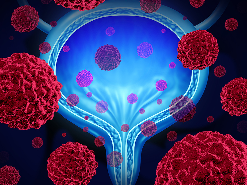 Red cells surrounding blue model of bladder
