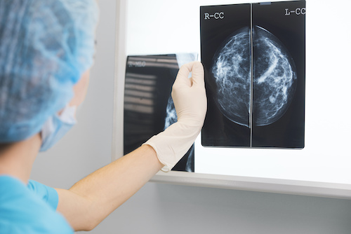 woman examining mammogram diagnostic image