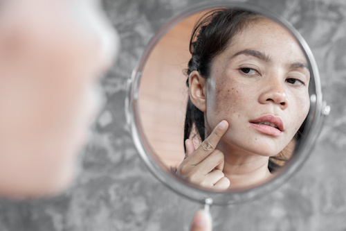 asian woman with freckles examining her face in a mirror