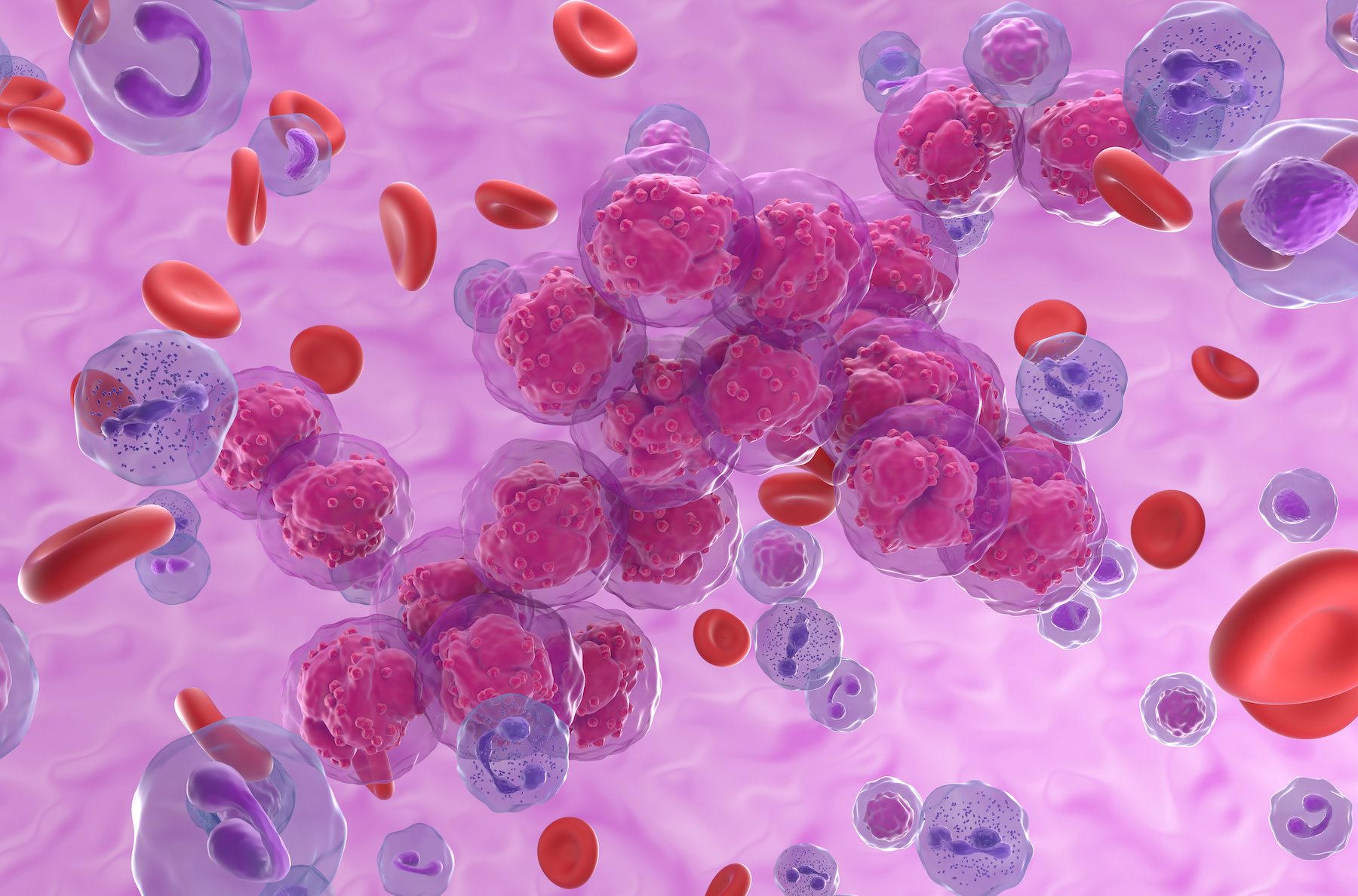 Acute lymphoblastic leukemia (ALL) cancer cell clusters in the blood flow - isometric view 3d illustration