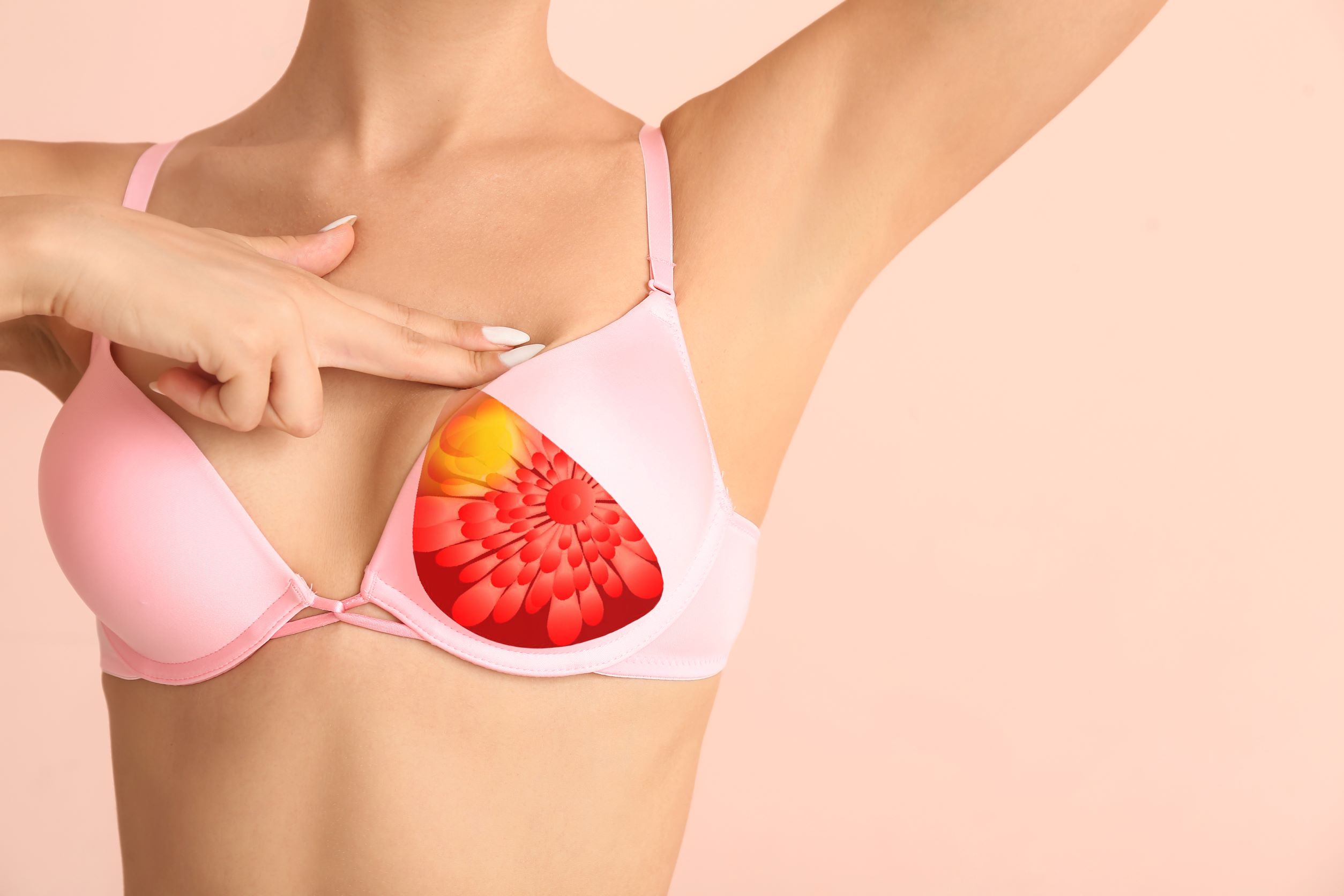 Smart bra acts as an early warning system for breast cancer