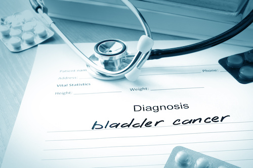 white clipboard with writing that reads diagnosis bladder cancer