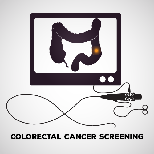 illustration of colon on screen with colonoscopy equipment