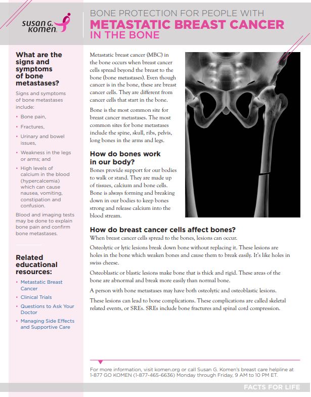 Metastatic breast cancer in bone