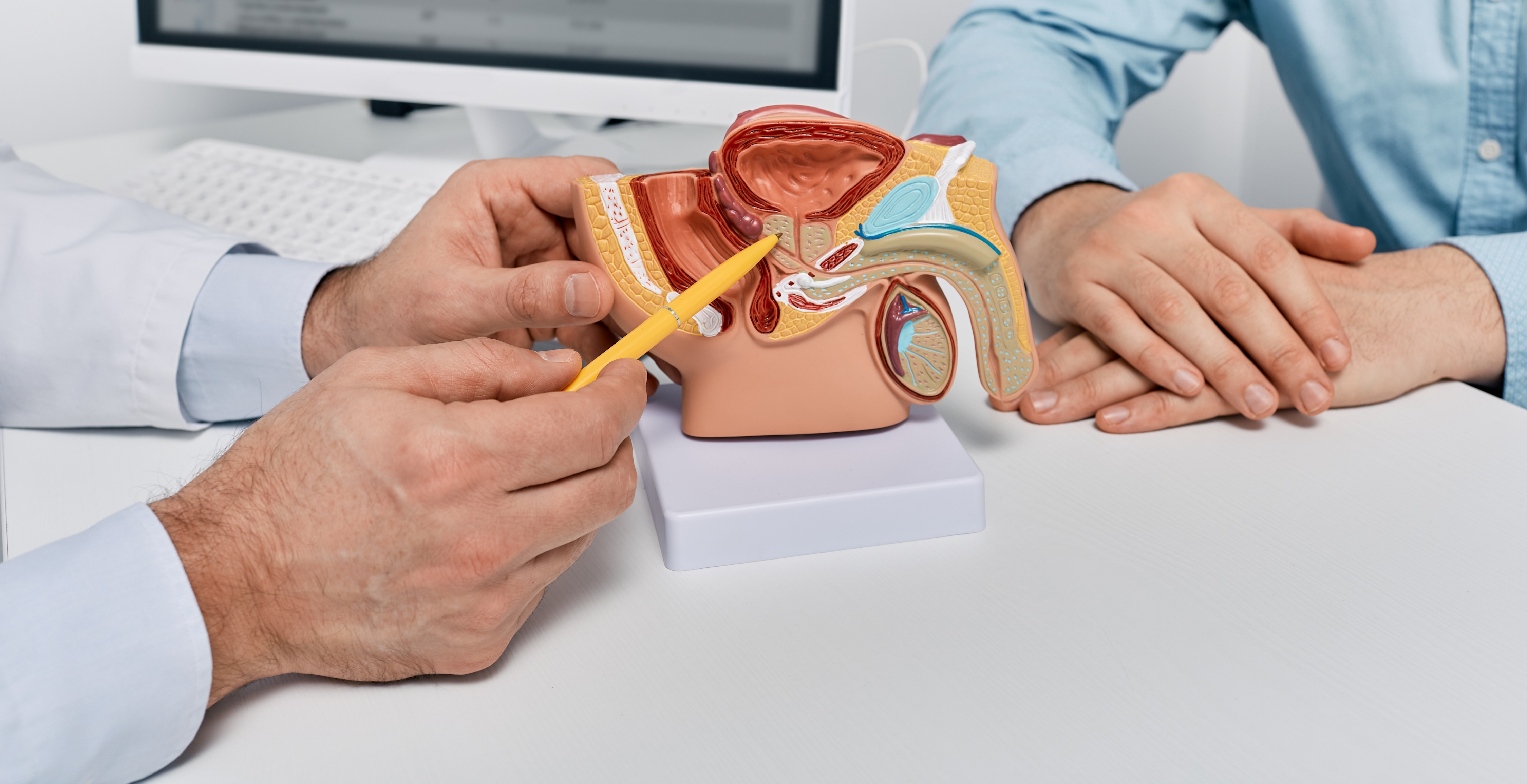 Doctor using pencil to pointing at model of a prostate as patient sits across the desk