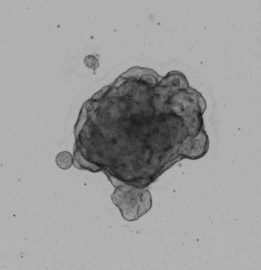 Colon Tumor Organoid Culture 12D