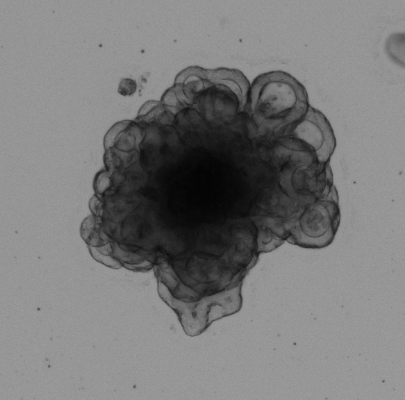 Colon Tumor Organoid Culture 15D