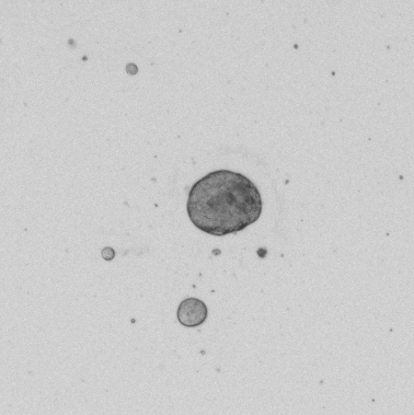 Colon Tumor Organoid Culture 1D