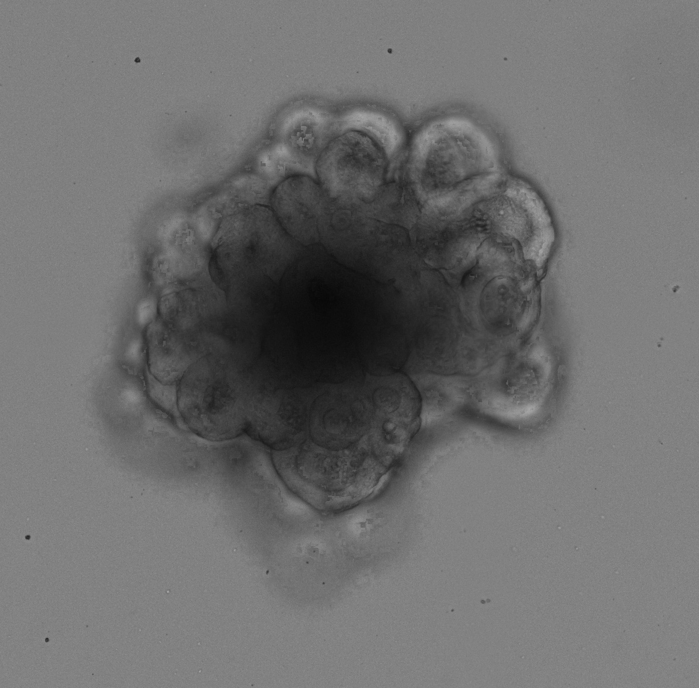 Colon Tumor Organoid Culture 20D