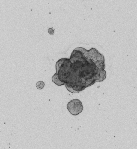 Colon Tumor Organoid Culture 8D