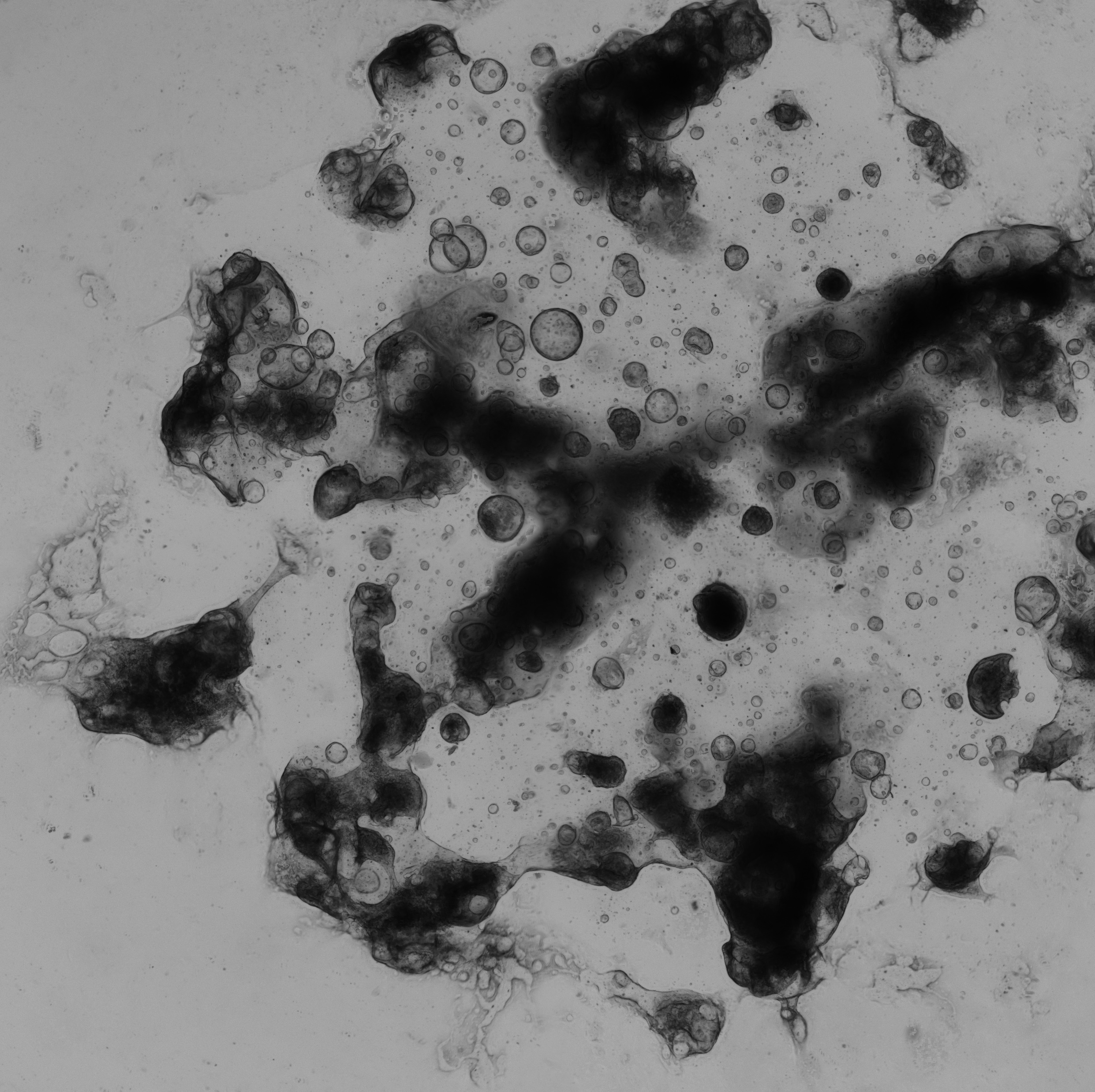 Liver Tumor Organoid Culture 15D