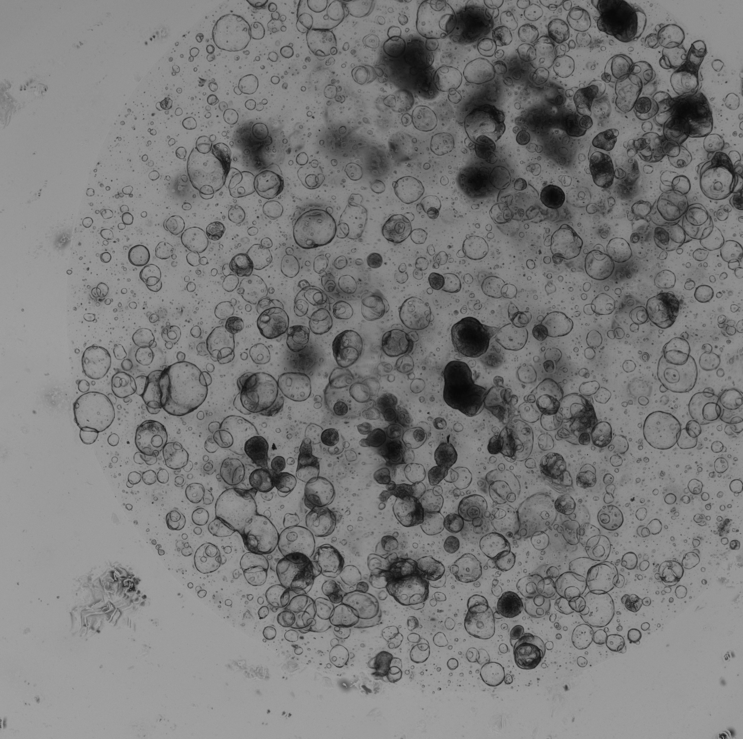 Liver Tumor Organoid Culture 1D