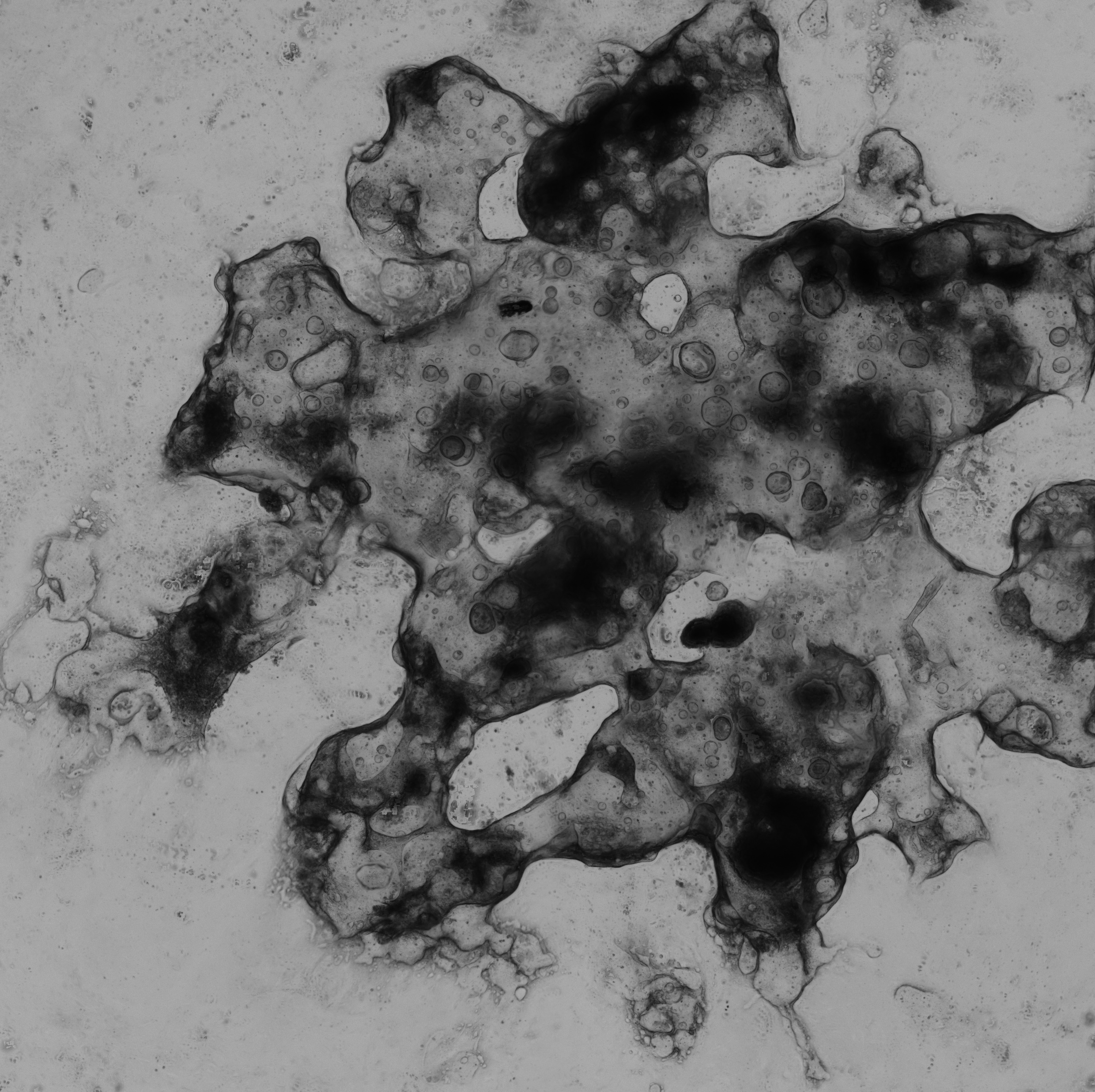 Liver Tumor Organoid Culture 22D