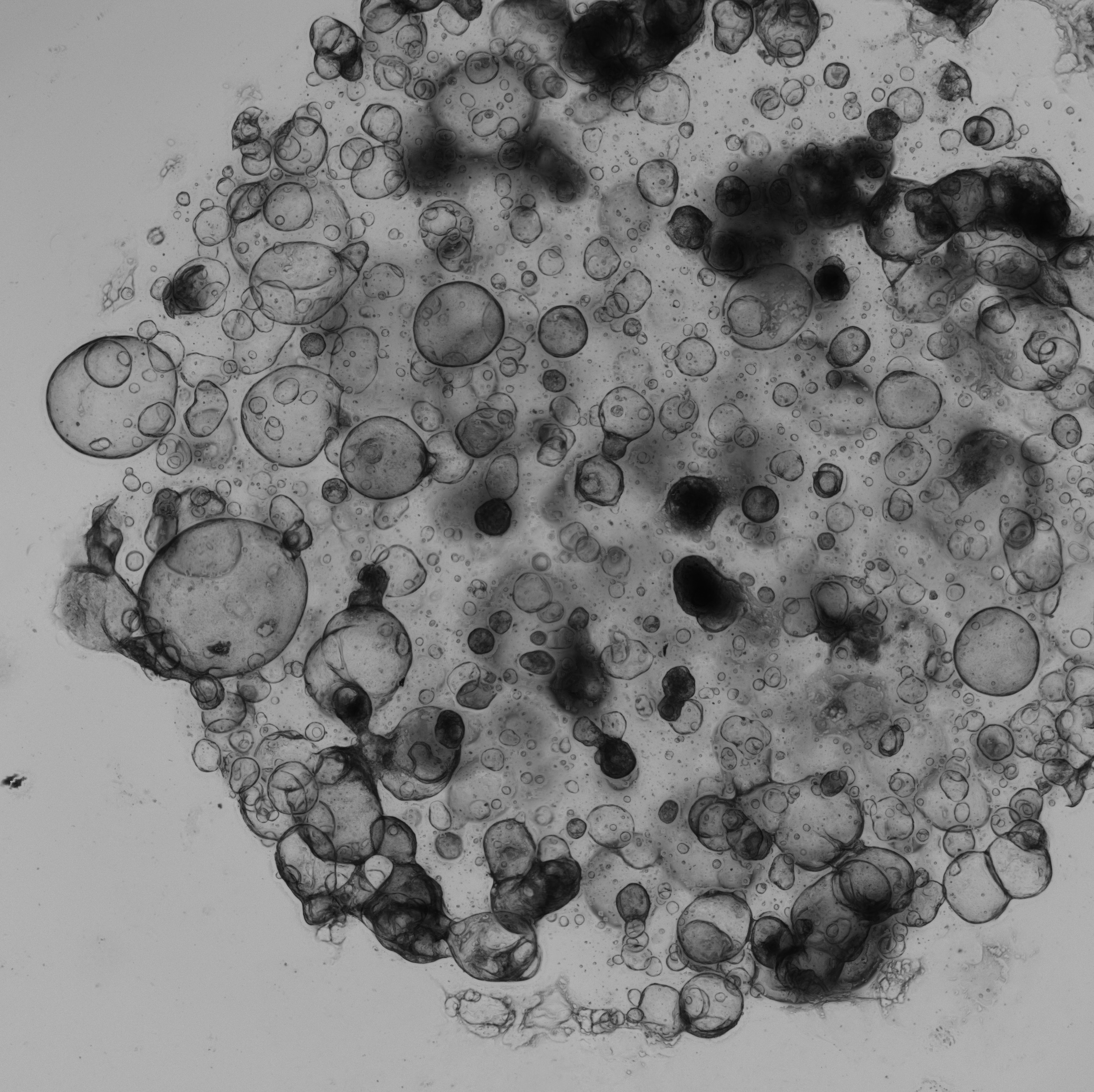 Liver Tumor Organoid Culture 8D