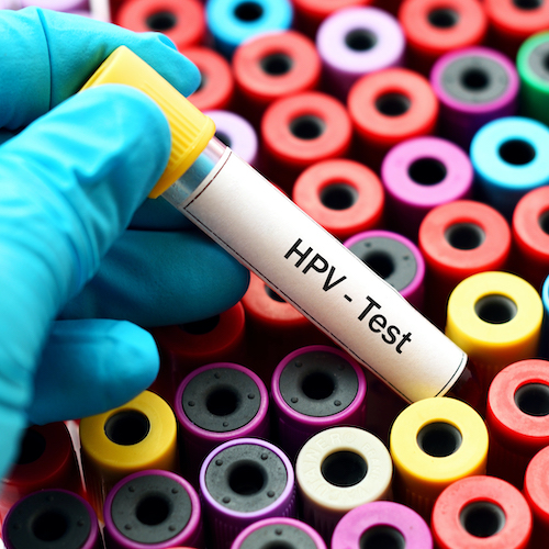 HPV test vial