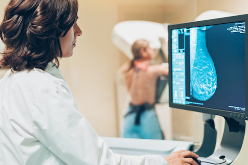 female patient receiving mammogram